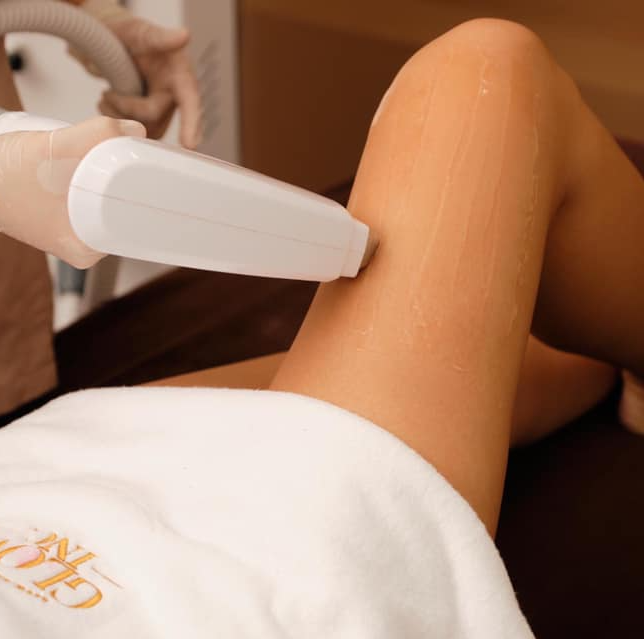 Diode Laser Hair removal